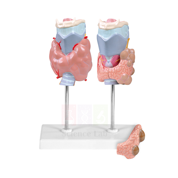 Pathology of the Human Thyroid Model